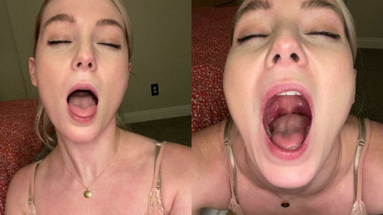 SAPSTACH BOCA ABIERTA