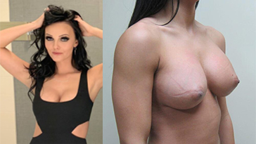 Watch Brittney Atwood Nude Boob Job Pictures Leaked on Gotanynudes.com