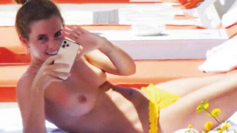 Watch Emma Watson Nudes Topless Leaked Holiday Sunbathing Small Tits on Gotanynudes.com